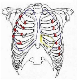 Fractured ribs when run over by a car Fractured ribs when run over by a car